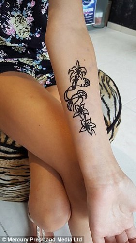 could be scarred for life after black henna tattoo goes could be scarred for life after black henna tattoo goes