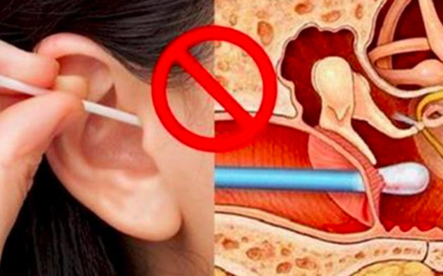 If You Use Cotton Swabs To Clean Your Ears, Stop!