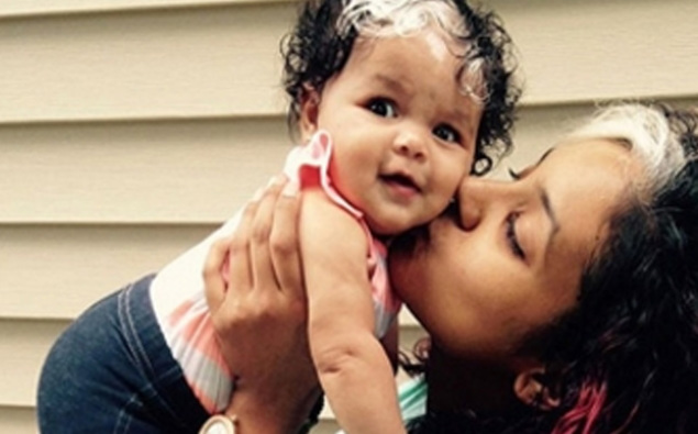 This Little Girl Was Born With The Same White Hair Streak As Her