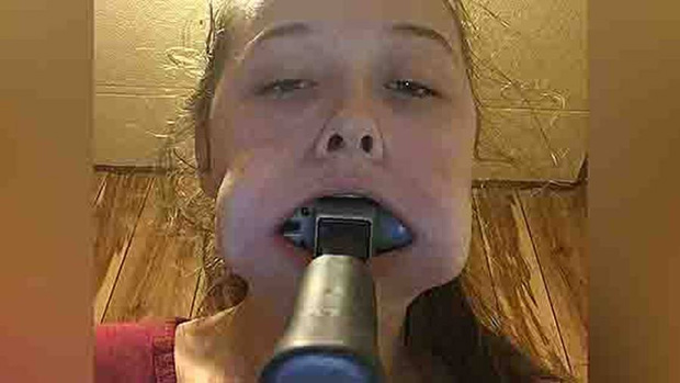 Kaley posted the picture on Twitter with the caption: 'how do u tell ur mum that u got a hammer stuck in ur mouth'. Photo / Twitter