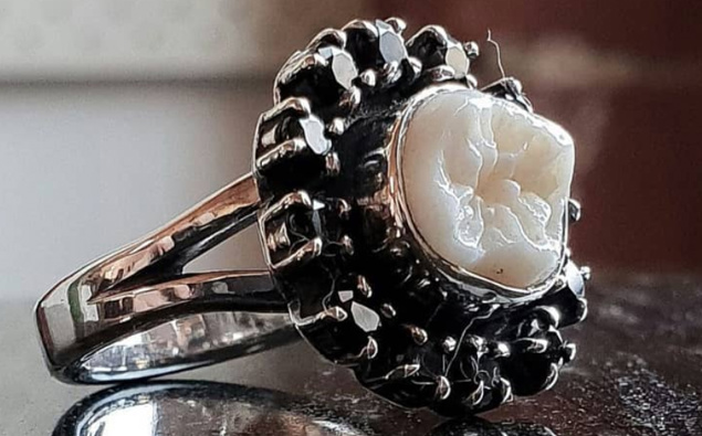 Human Teeth Rings Revolting or romantic? Jeweller makes engagement rings out of human teeth