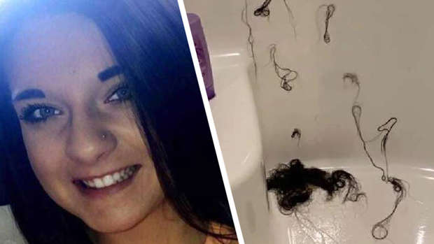 Woman S Hair Loss Horror After Pantene Conditioner Tampered With