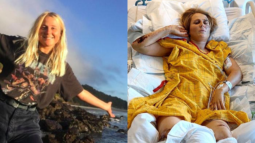 Kiwi's 'horrific' US rock climbing accident led to leg amputation, now generous people are trying to help