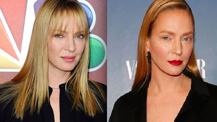 What's Happened To Uma Thurman's Face?