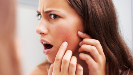 These are the five types of pimples you should NEVER pop according to experts