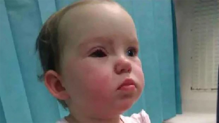 Mother's warning after toddler suffers horrific eye injury in store