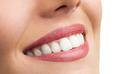 This is the BIZARRE new beauty trend everyone is doing ... and it's called teeth polish!