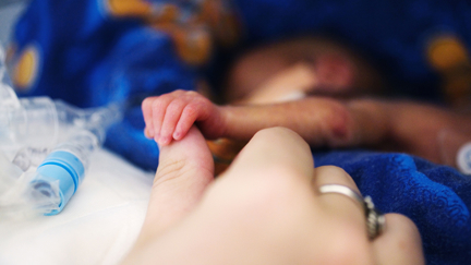 World's smallest surviving baby born weighing just the same as an apple!
