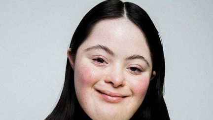 Ellie Goldstein, model with Down syndrome, stars in Gucci's latest beauty campaign